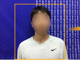 備案拍照標準體位